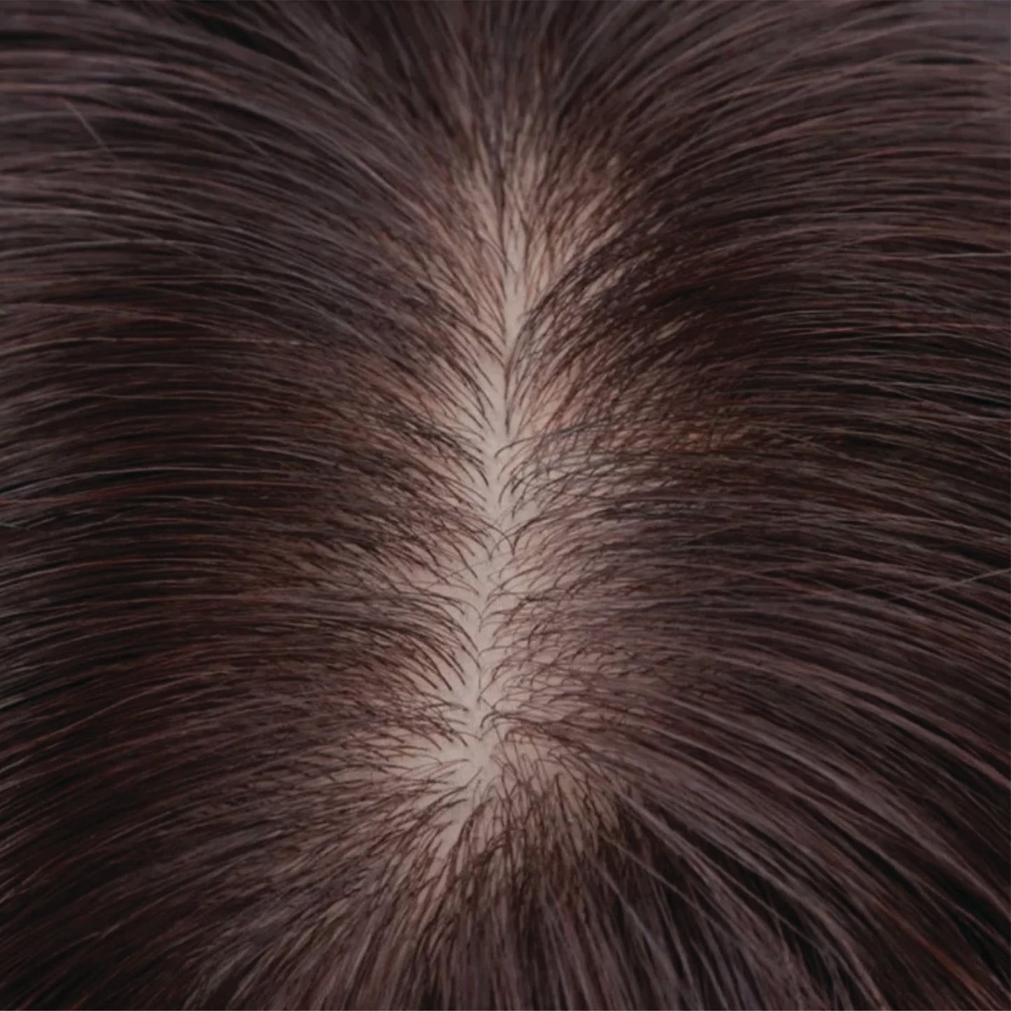 🔥Last Day:90% Off🔥Silk Base Human Hair Topper
